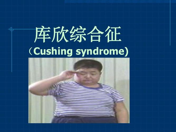 syndrome-syndrome怎么记忆